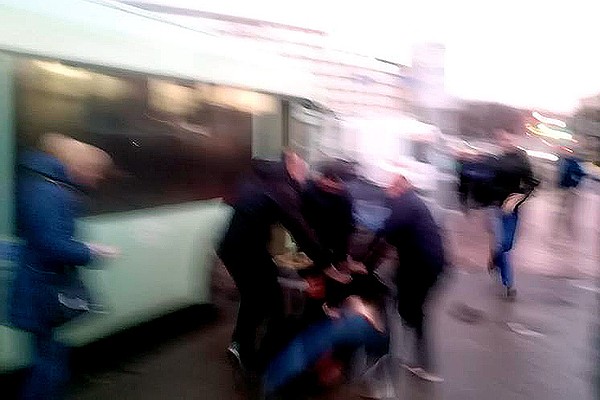 Варикозное расширение вен толстого кишечника