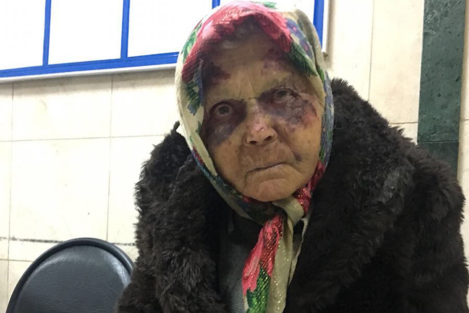 Избитую женщину нашли волонтеры «Лизы Алерт» почти неделю спустя практически при смерти