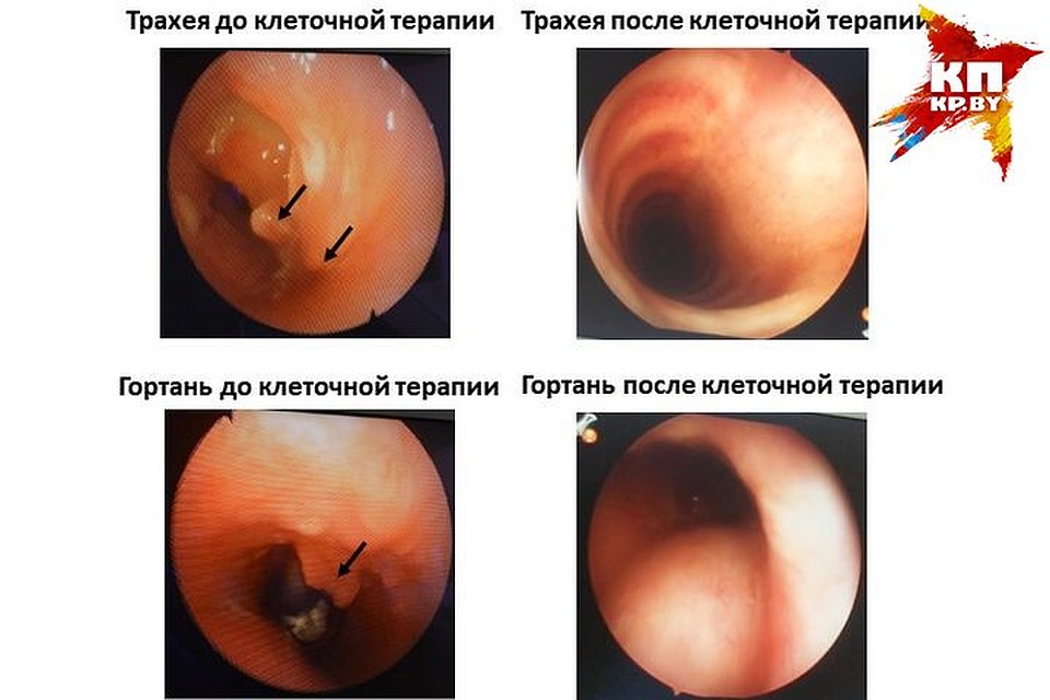 Болезни трахеи, ринит, дерматит: белорусские ученые разрабатывают метод избавления от многих воспалительных заболеваний. Фото: архив.