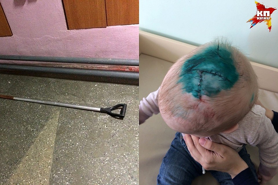 На мальчика с крыши скинули лопату. Фото предоставлено Полиной Неустроевой