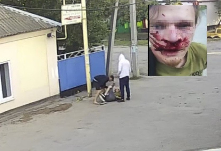 Полицейский не отреагировал на звонок, а через несколько минут авиаинженер был жестоко избит. Фото: соцсети