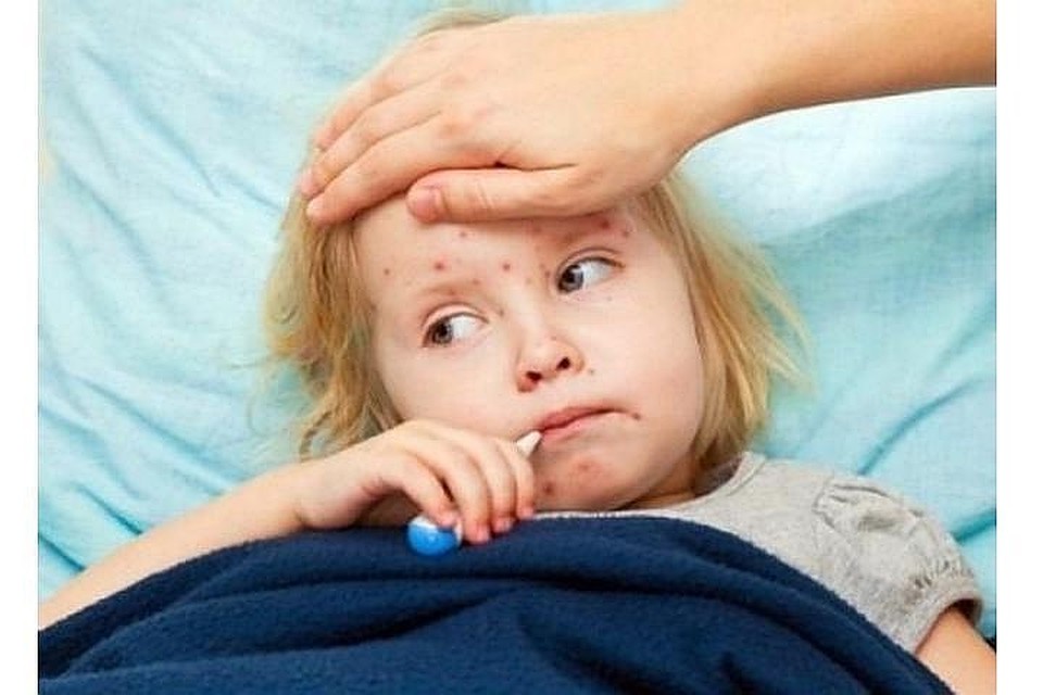Дети болеют корью.