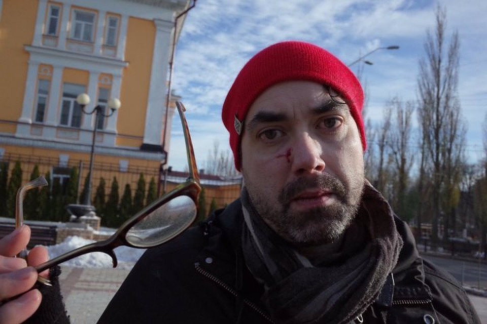 Канадский журналист Майкл Колборн после нападения. Фото: twitter.com/@ChristopherJM