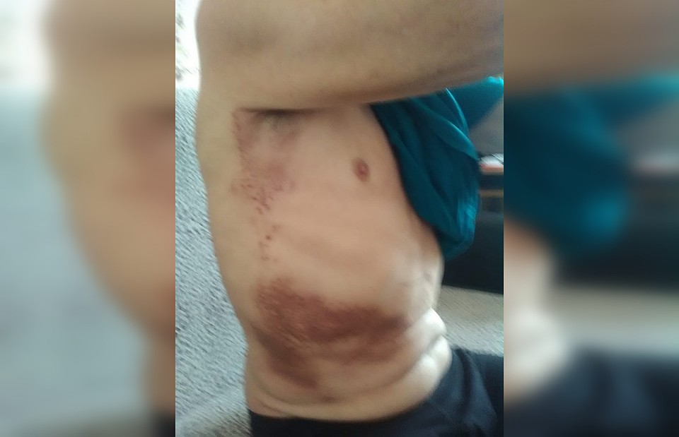 В приюте парализованного мужчину никто не мыл, не менял ему белье. Фото: Гражданский патруль.