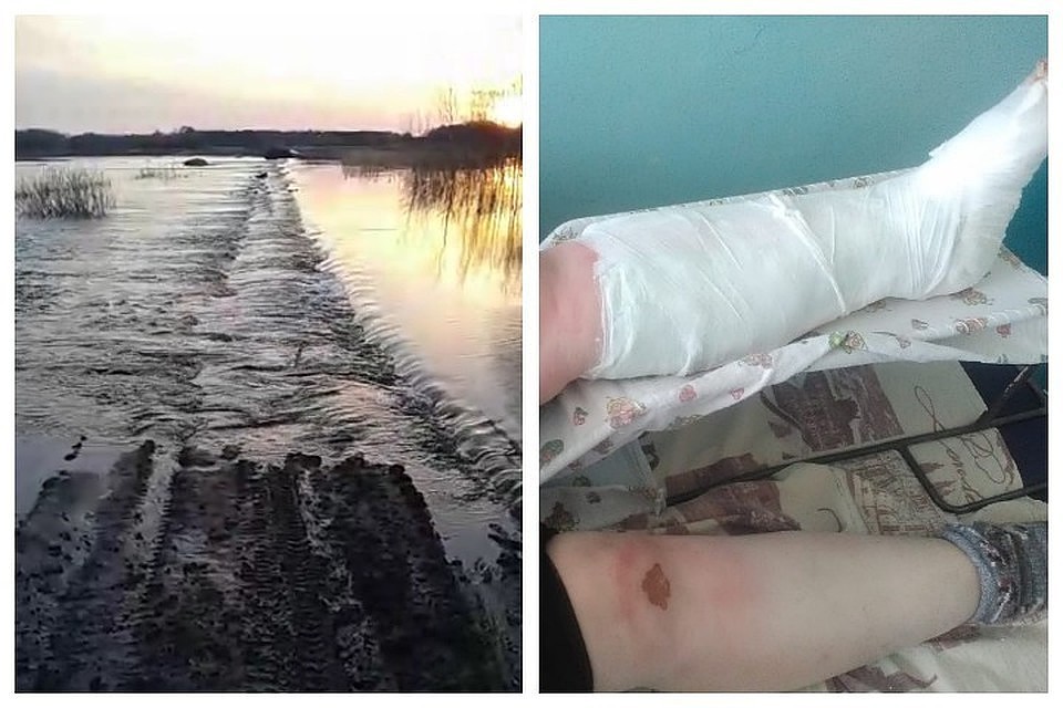 Такие травмы у Нины Федоровны остались после той страшной ночи.