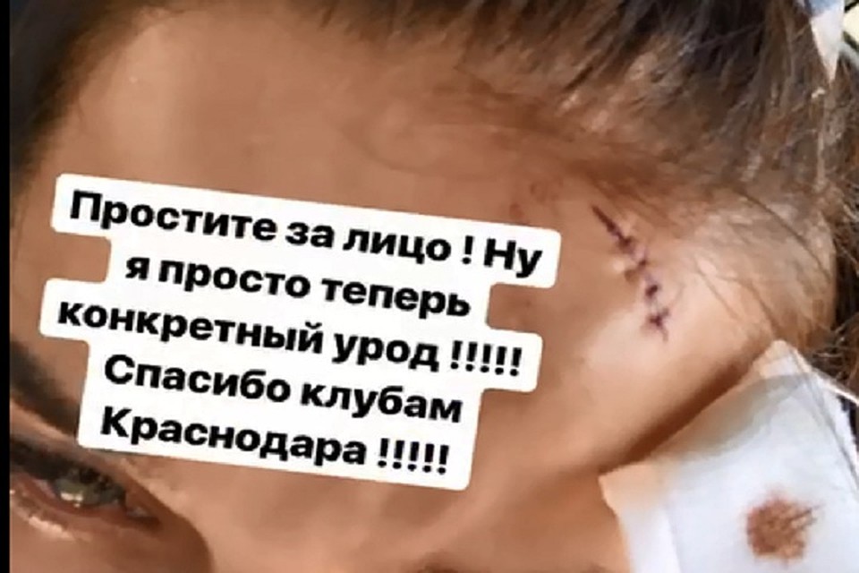 ФОТО: Скриншот сториз аккаунта инстаграм kristinavitalievna_