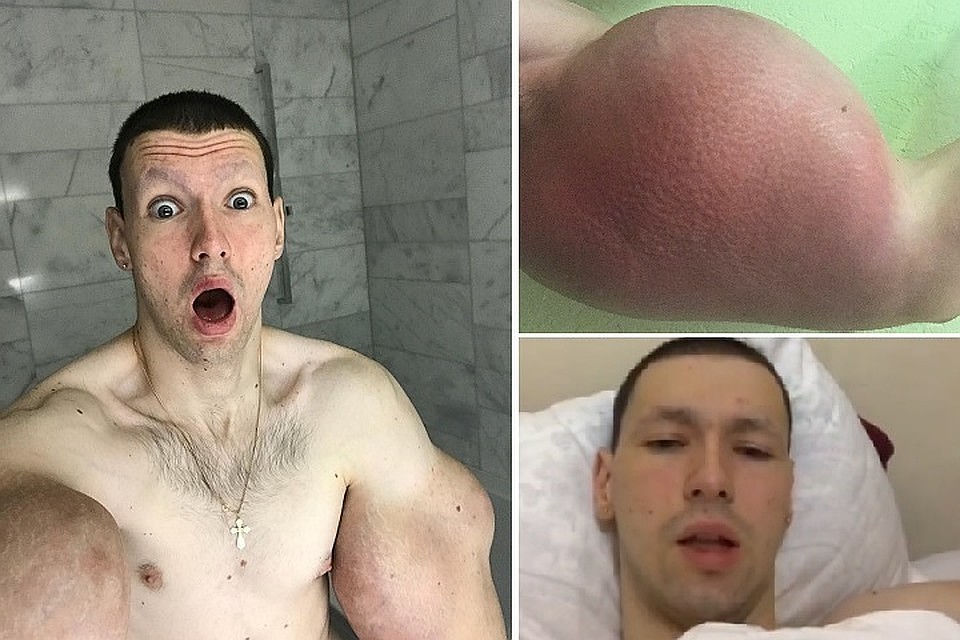 "Синтоловый качок" записал первое видео из больницы