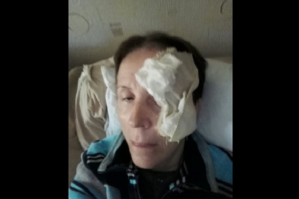 Вера Панасенко через несколько часов после ЧП (Фото: личный архив Веры Панасенко).