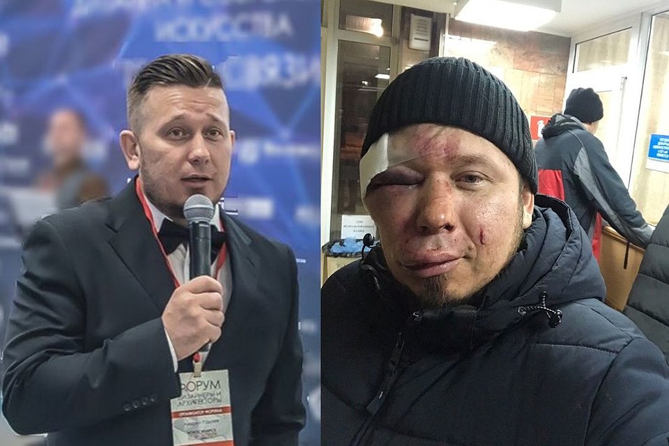 Андрея Радаева не узнать. Он получил несколько серьезных ударов по голове. Фото: личный архив.
