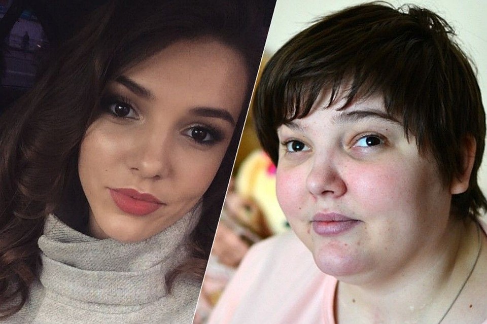 После страшной аварии Маша ослепла и сильно изменилась. Фото: www.instagram.com/mashulka_lebedeva/ Влад КОМЯКОВ.