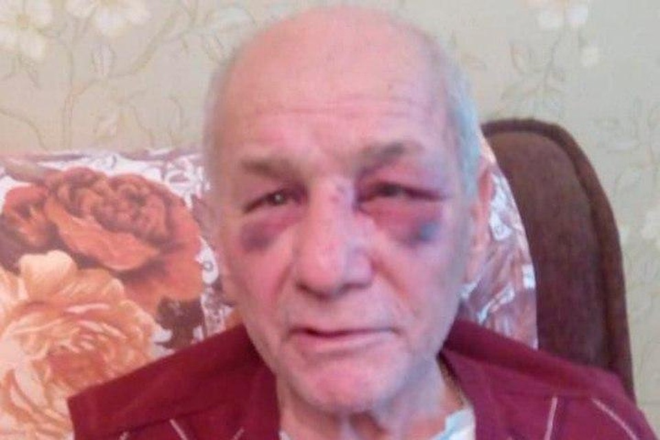 Жору Мирзояна, по его словам, избил врач Фото: предоставлено Ириной Шихофой