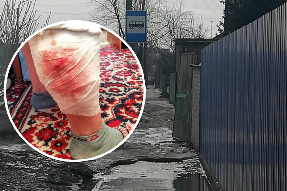 Собака напала на сибирячку рядом с остановкой «Спартака». Фото: личный архив.