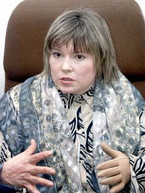 Лариса Гамова: ее, горевшую заживо, чудом спасли японские врачи.