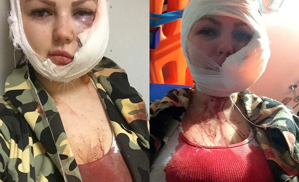 О том, как попала в больницу, Ирина уже не помнит.