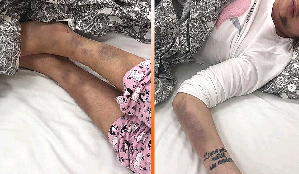 МакSим попала в серьезное ДТП по дороге в аэропорт. Фото: Личная страничка героя публикации в соцсети