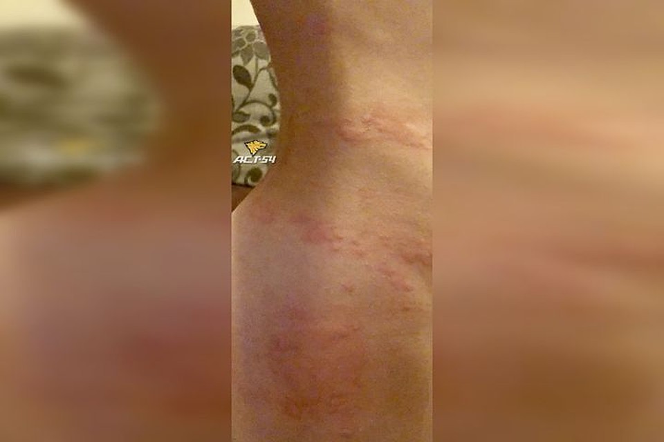 По словам жителей дома, после их попытки вытравить насекомых, клопы переселились к соседям. Фото: "АСТ-54"