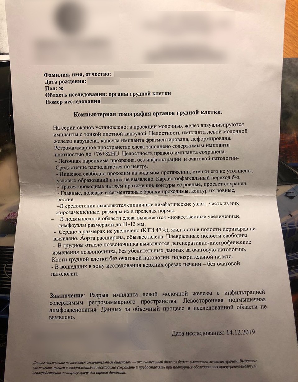 КТ подтвердила опасения Фото: предоставлено героиней материала