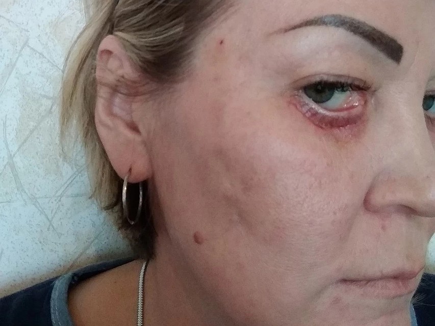Очередной брак в хирургической карьере Татьяны