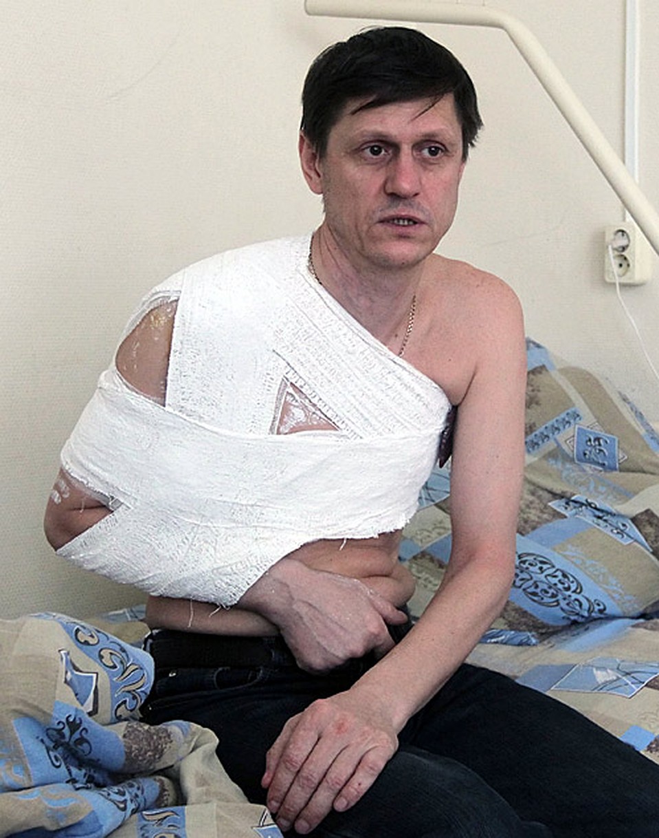 Сейчас Анатолий Жданов с двойным переломом ключицы находится в больнице Фото: АП