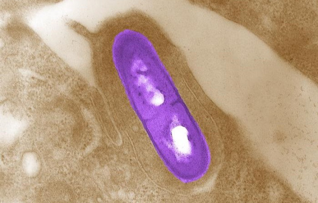 Листериоз у человека: симптомы, возбудитель, пути заражения, формы ...