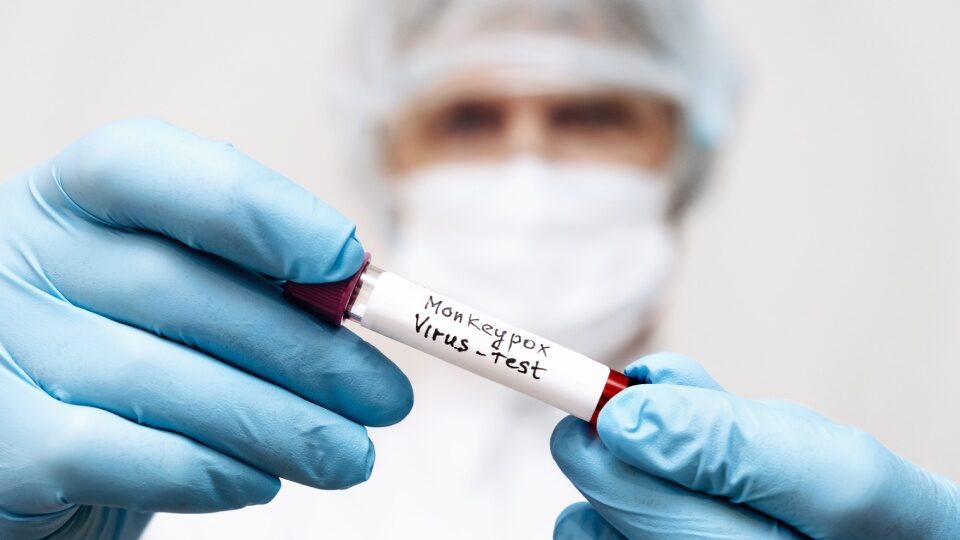 Оспа обезьян в 2025 году у взрослых