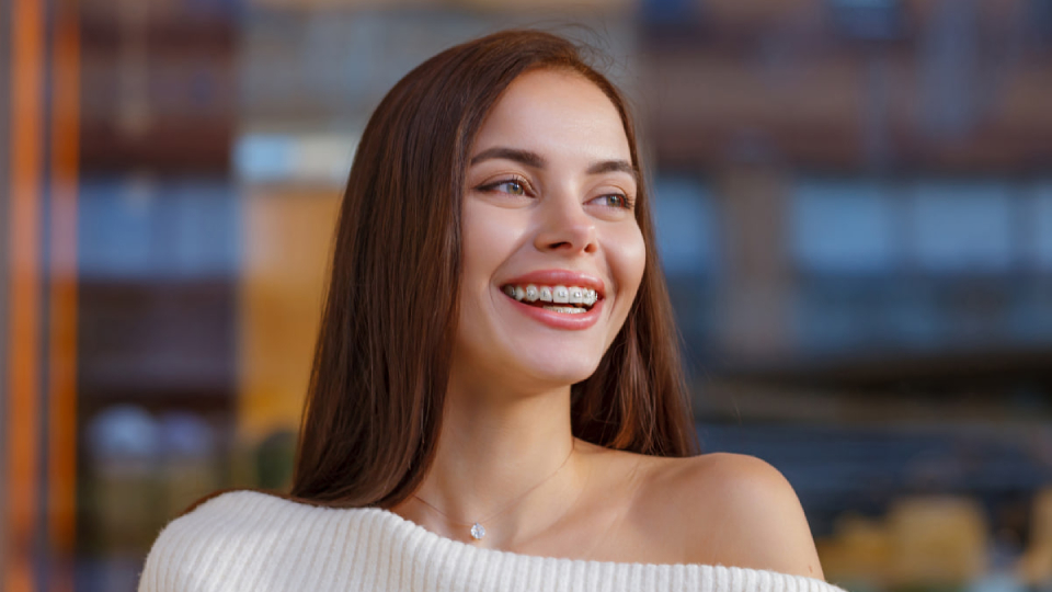 Сколько носят брекеты для выравнивания зубов