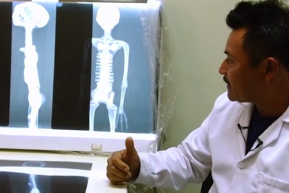 Рентген мумий выявил их нечеловеческие особенности.