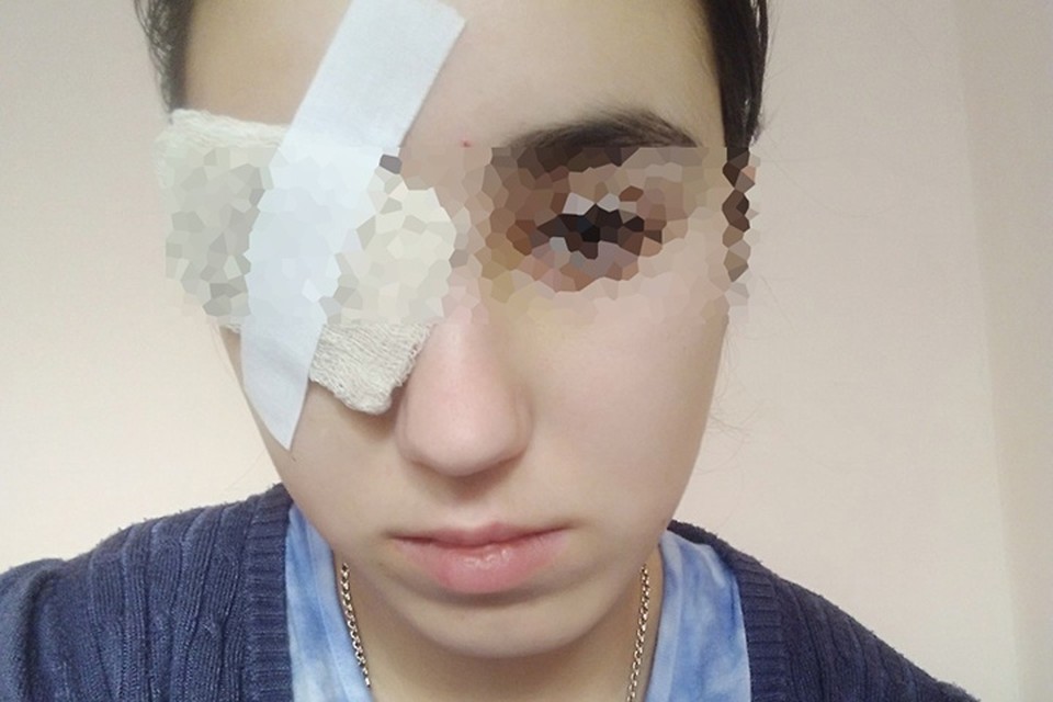 В Рыбинске петарда попала в глаз 17летней девушке во