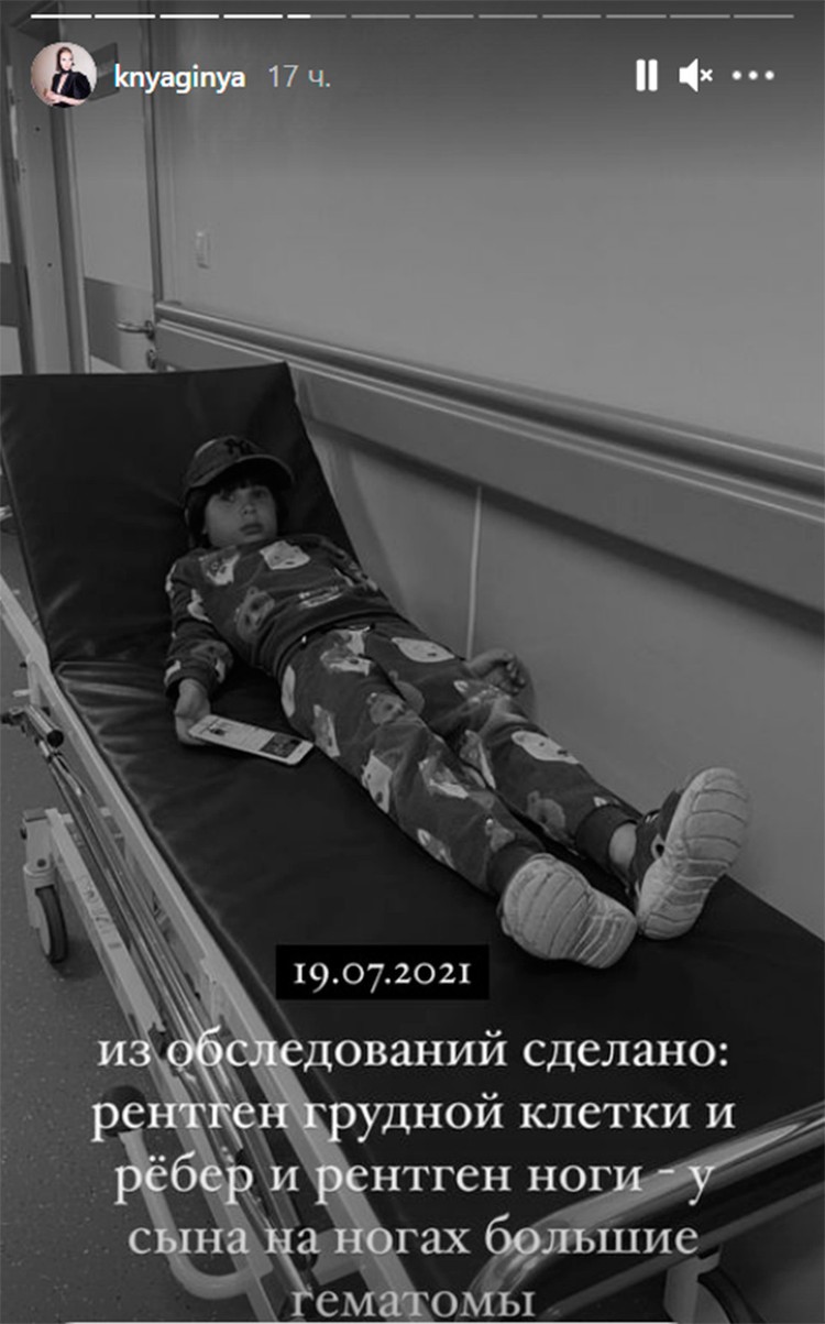 Мальчик попал в больницу с сотрясением. Фото: www.instagram.com/stories/knyaginya/